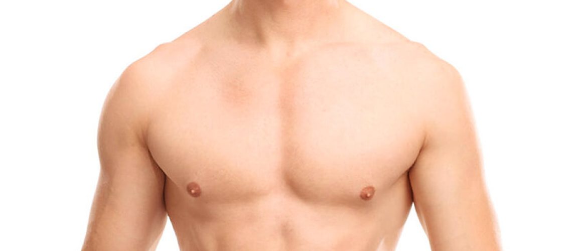 Ginecomastia