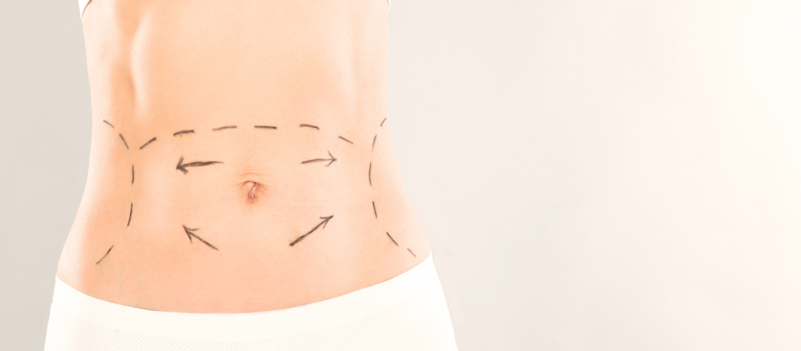 Lipoaspiração e cirurgias de contorno corporal são tendência no Brasil e no mundo.